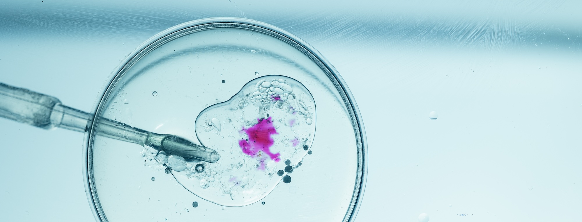 a needle injecting a liquid onto a petri dish