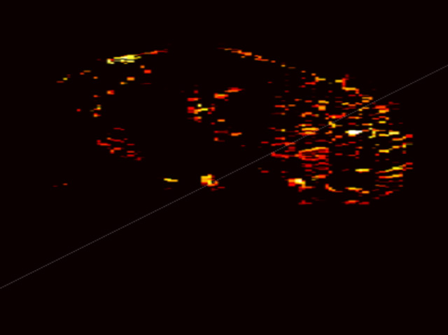 Photoacoustic map of kidney without scarring