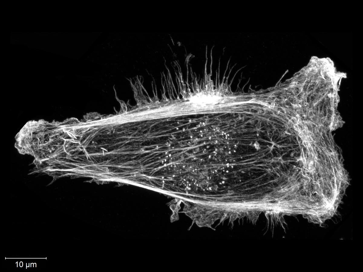 A black and white image of the cytoskeleton of a human breast cancer cell. 