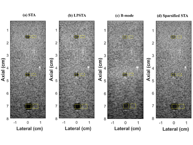 Images obtained from Verasonics Vantage Research System. It demonstrates the LPSTA.